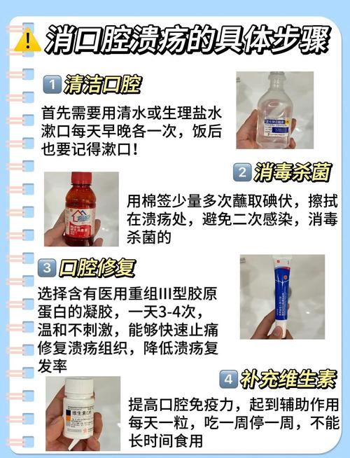 口腔溃疡怎样缓解疼痛