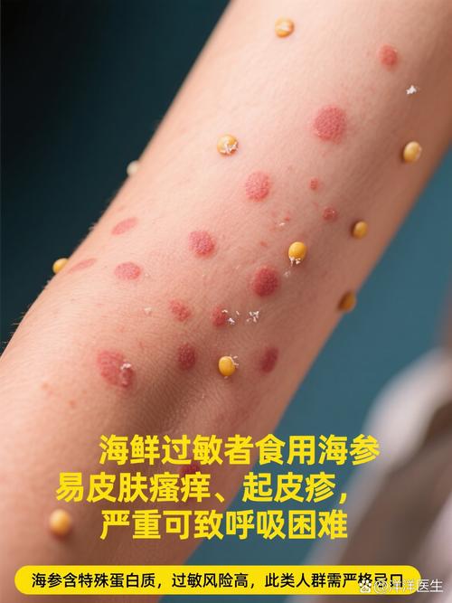 皮肤过敏可以吃海参吗