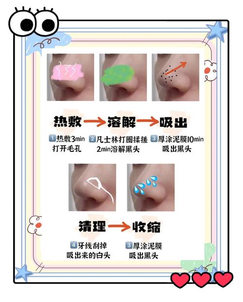 医院皮肤科能去黑头吗