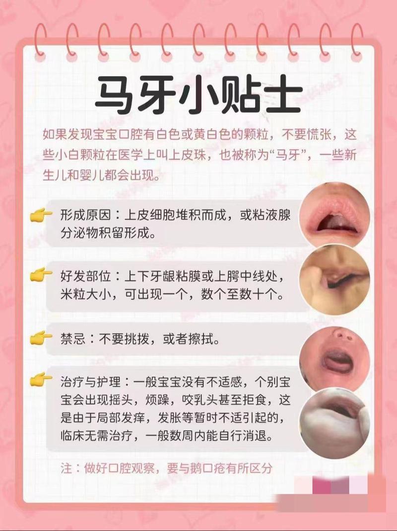 婴儿正常口腔上颚图片