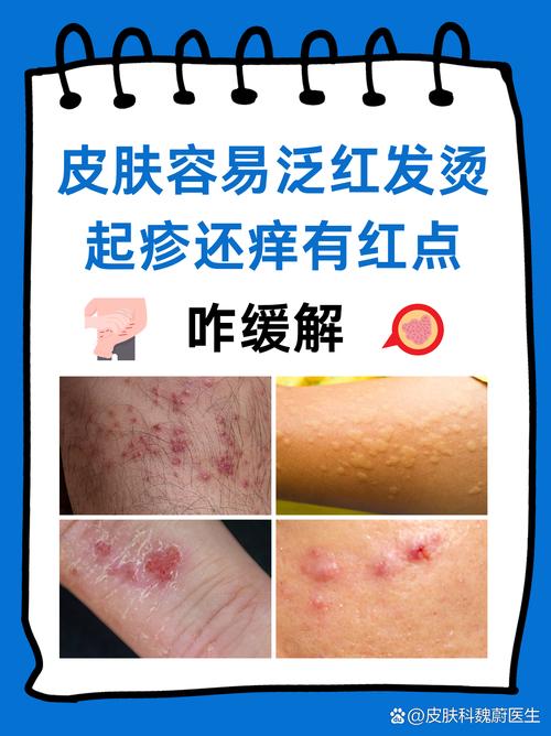 上身皮肤瘙痒是何原因?