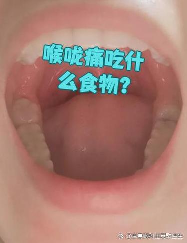 总感觉有食物在喉咙口