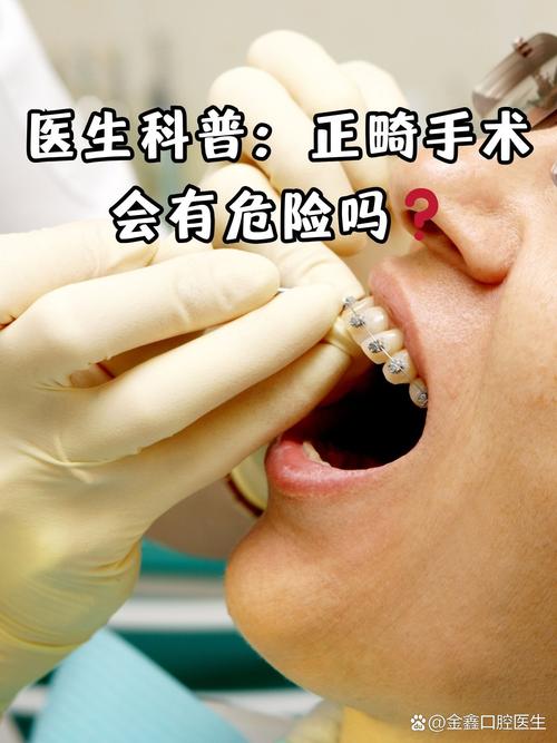 口腔开窗手术恢复期要多久?