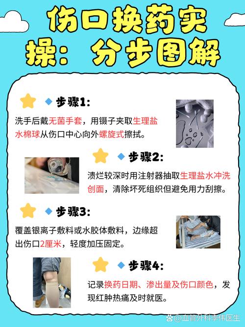 静脉曲张皮肤痒怎么快速缓解?