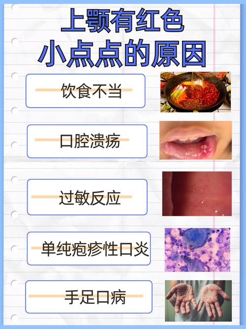 霉菌性口腔炎会传染吗