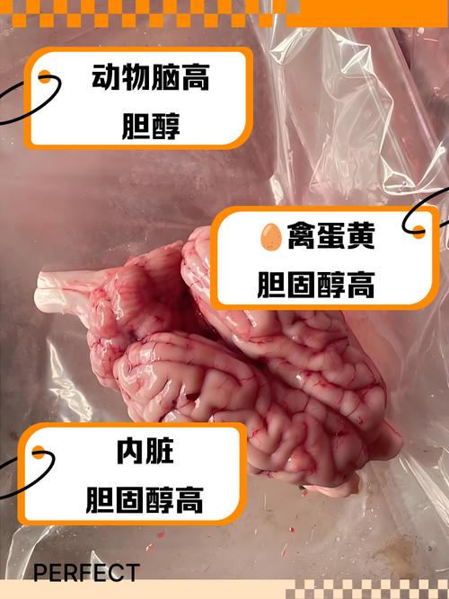 胆固醇高怎么吃才健康?