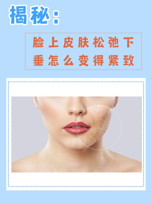 皮肤松弛怎么有效紧致?