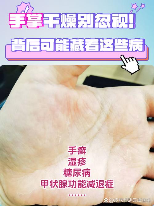 手关节皮肤痒怎么回事