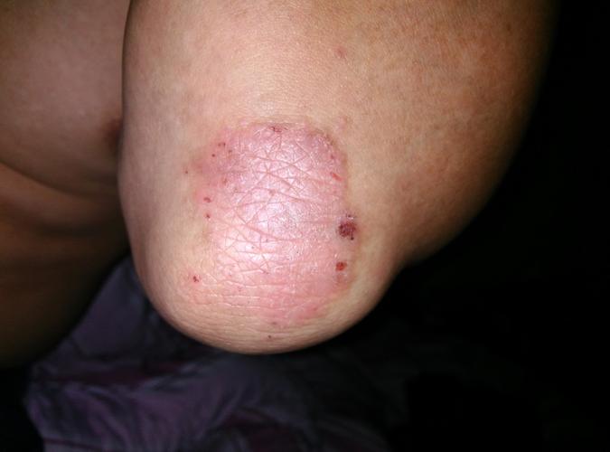 手关节皮肤痒怎么回事