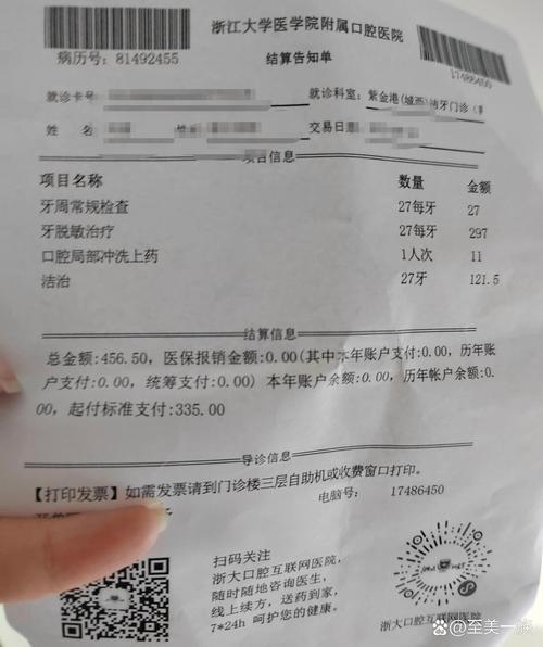 浙江口腔医院洗牙费用多少?