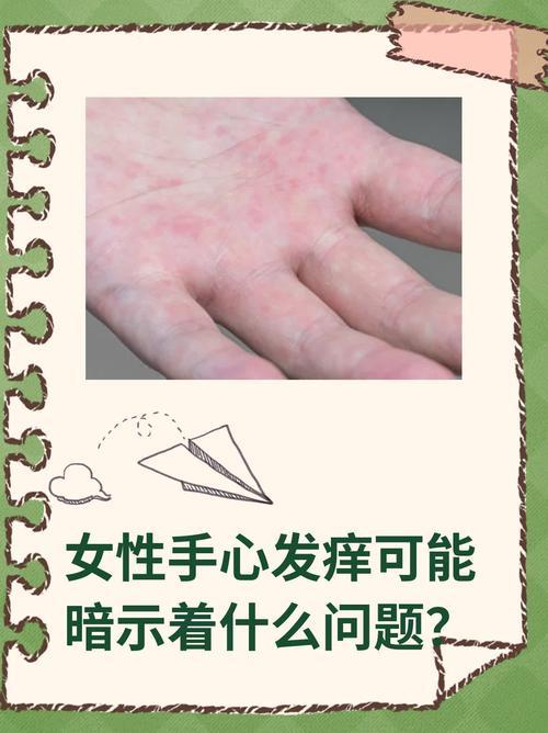 手掌皮肤痒是怎么回事