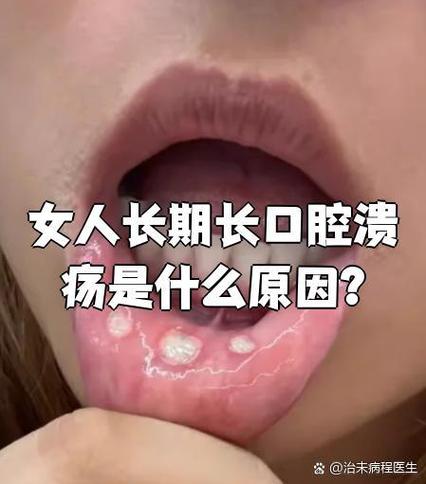 为什么例假前口腔溃疡