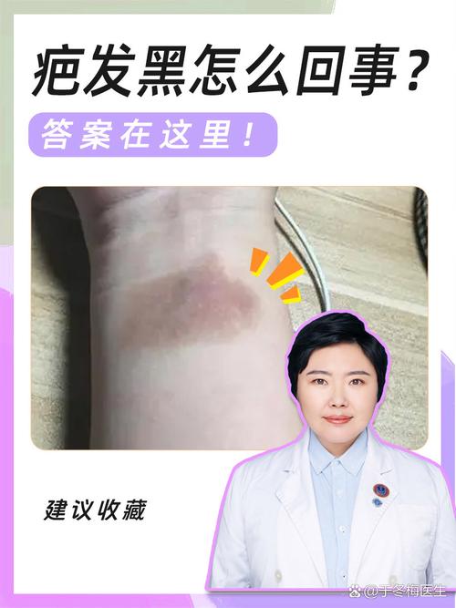 化疗后皮肤变黑怎么办