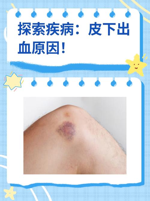 皮肤无故出血怎么回事