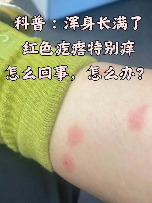 皮肤长包痒是何原因引发?