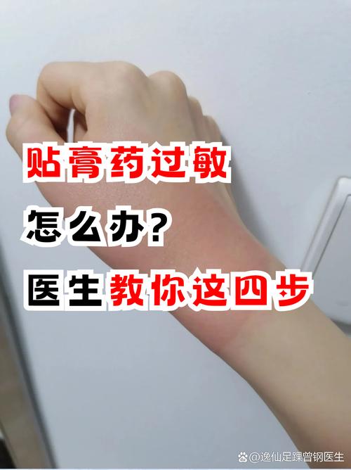 贴完膏药皮肤痒怎么办?