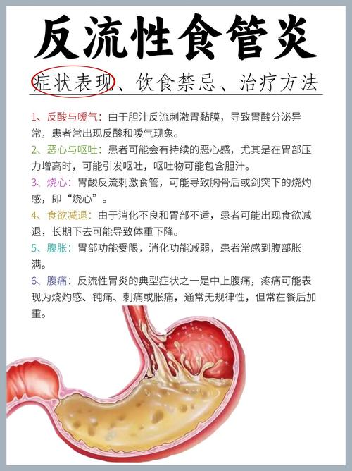 食物中毒多久能好?