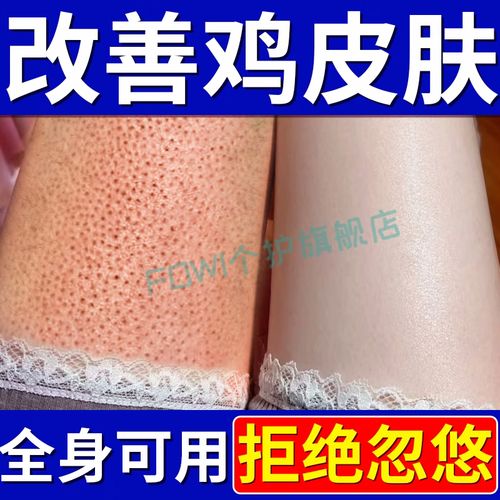 磨砂膏真能去鸡皮肤吗?
