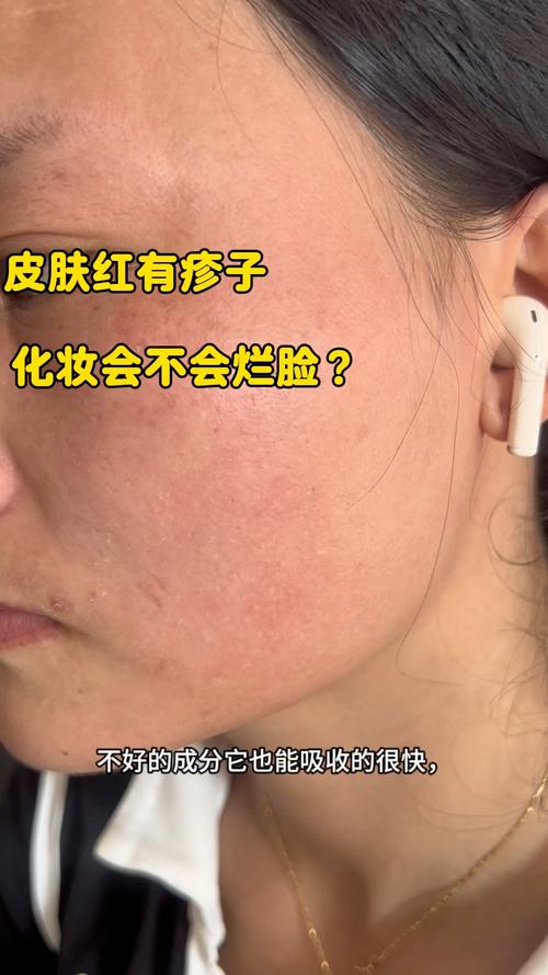 化妆真的会伤皮肤吗?