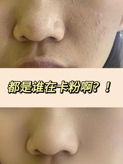 化妆真的会伤皮肤吗?