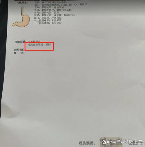 吃过烫食物喉咙被烫到