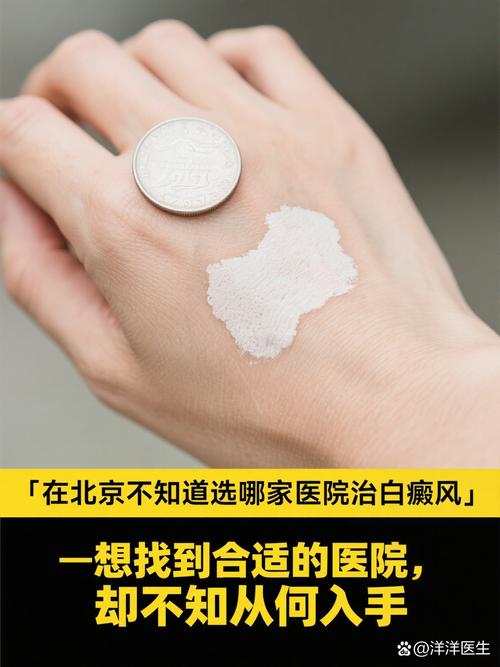 北京看皮肤病,哪家医院最靠谱?
