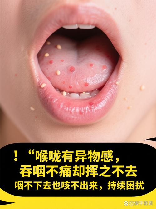长期口臭伴口腔异物感是何原因?