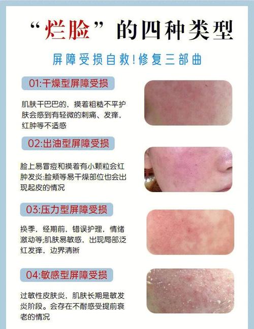 皮肤细胞受损后,身体如何自我修复?