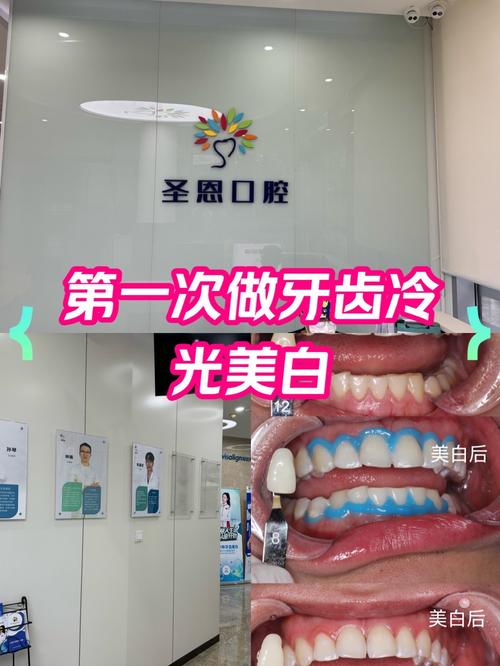 天津口腔医院美白牙齿