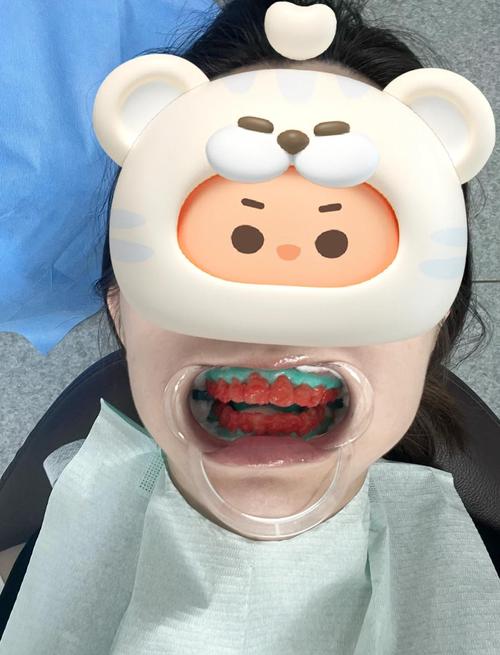 天津口腔医院美白牙齿