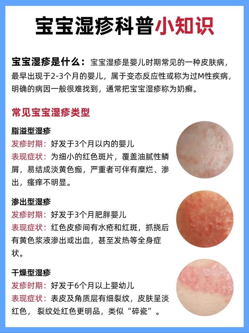 新生儿皮肤过敏怎么办?