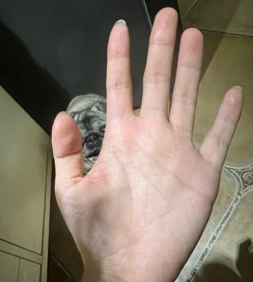 皮肤被辣椒辣了怎么办?