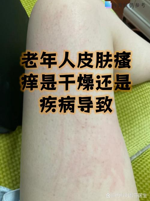 皮肤病为何久治不愈?