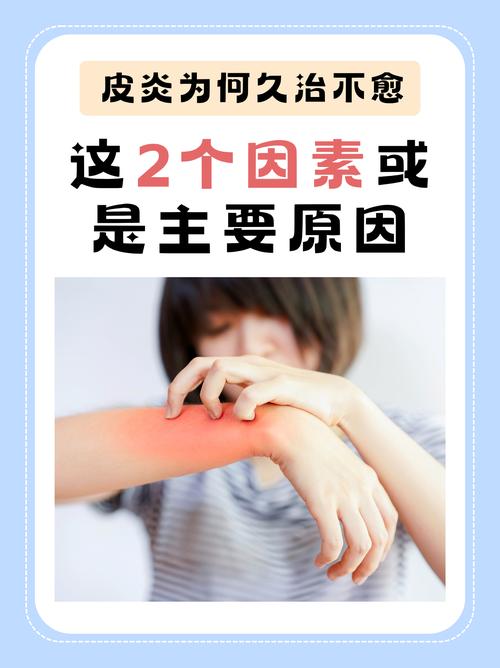 皮肤病为何久治不愈?