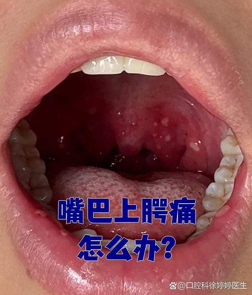 口腔不舒服是哪些疾病的征兆?