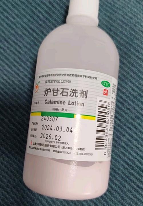 皮肤过敏能用炉甘石吗?