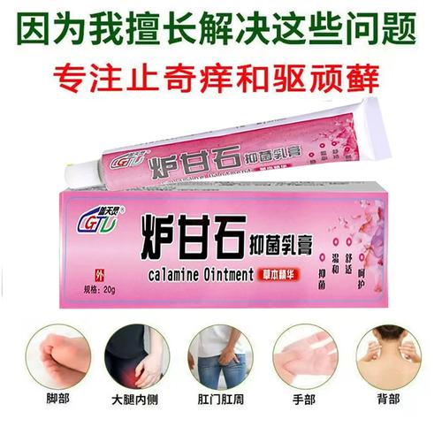 皮肤过敏能用炉甘石吗?