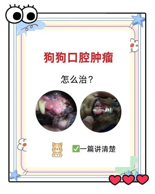 口腔颌面部肿瘤治愈率究竟有多高?