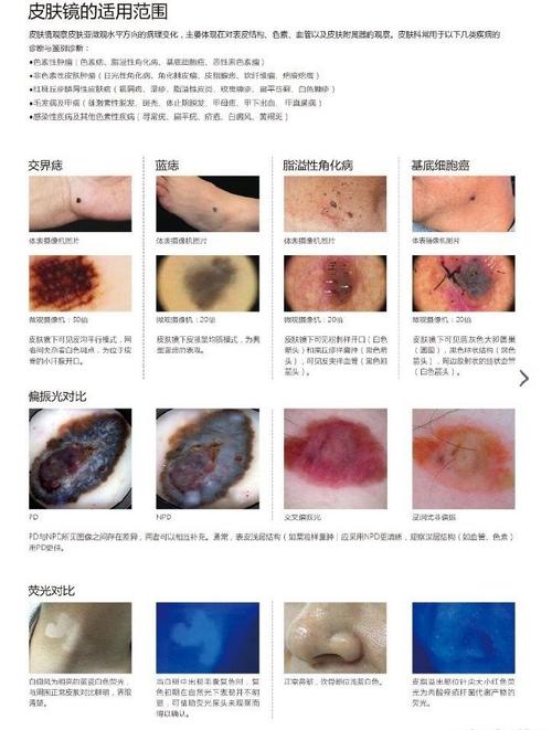 皮肤肿瘤诱因有哪些?