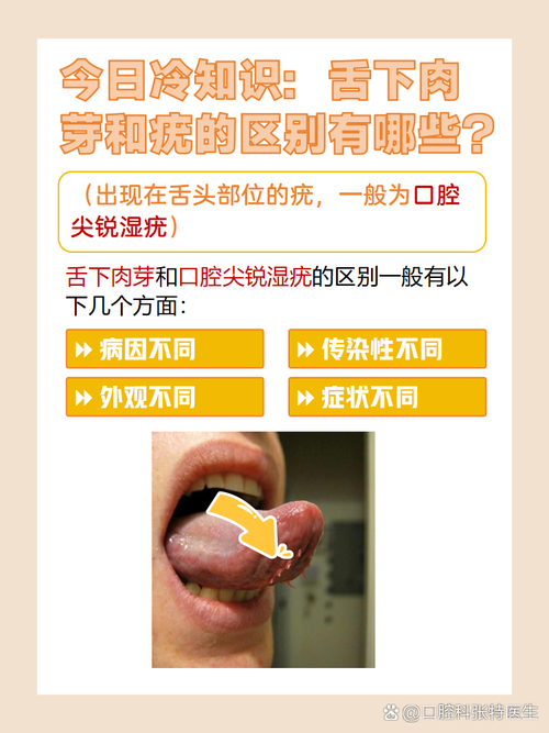 舌头口腔尖锐湿疣如何处理?