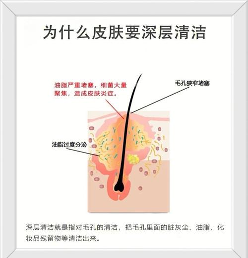 自己怎么深层清洁皮肤?
