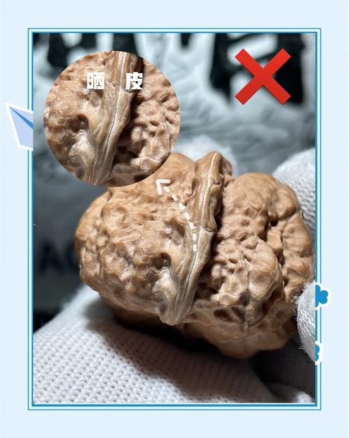 皮肤过敏能吃核桃吗?