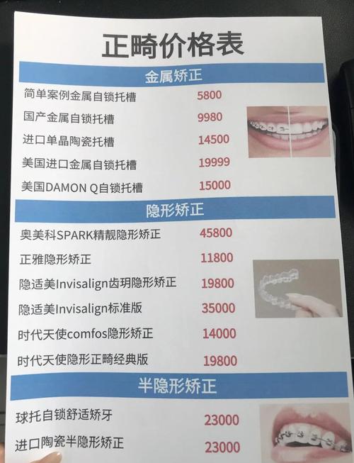 杭州口腔医院正畸价格多少?