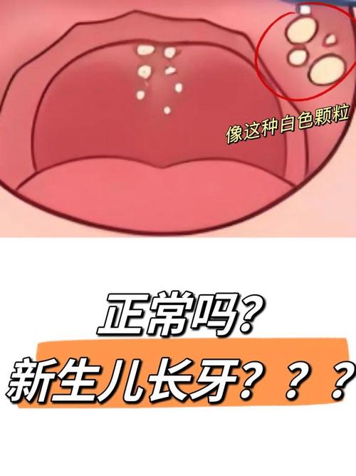 口腔内白色点点是何原因?