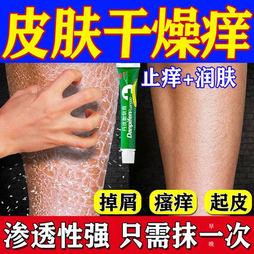 冬季皮肤干痒,抹药还是口服药?