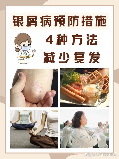 糖尿病皮肤瘙痒如何有效缓解?