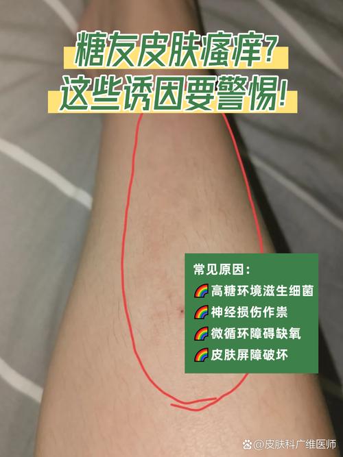 糖尿病皮肤瘙痒如何有效缓解?