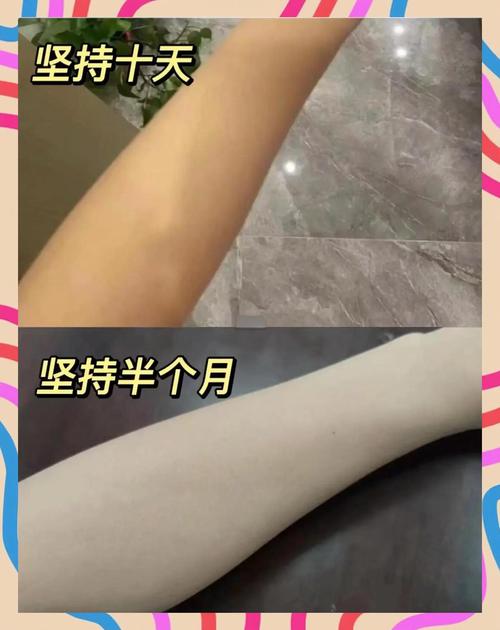 天生黑皮肤能变白吗?