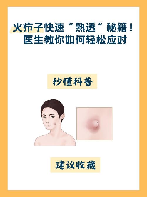 皮肤长脓包是感染还是其他原因?