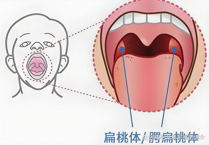 鼻腔口腔连接处为何总发苦?